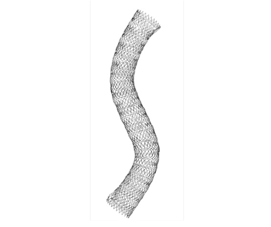 The VICI VENOUS STENT System from Boston Scientific